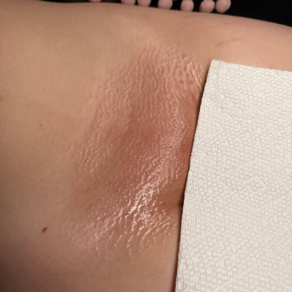 Brazilian wax at Aesthetically You in Minneola, FL