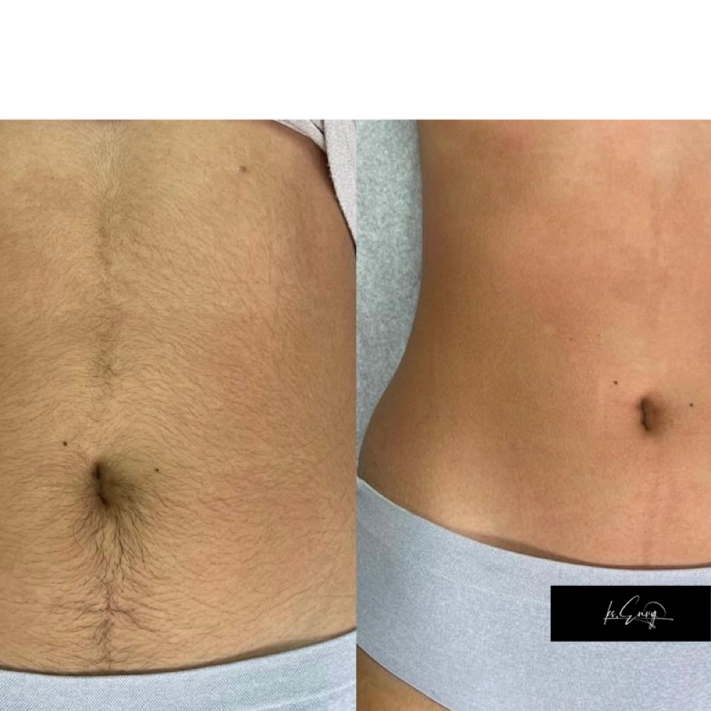 Stomach: Full at KS.Envy in Columbus, OH