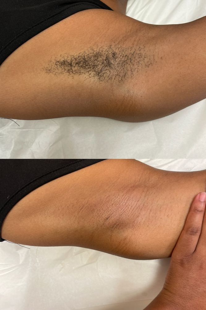 UNDERARM WAX at Mya Morgan in Bossier City, LA