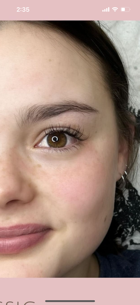 Classic Fill (2 Weeks)