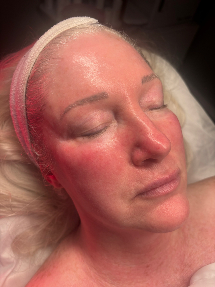 Korean Glass Facial