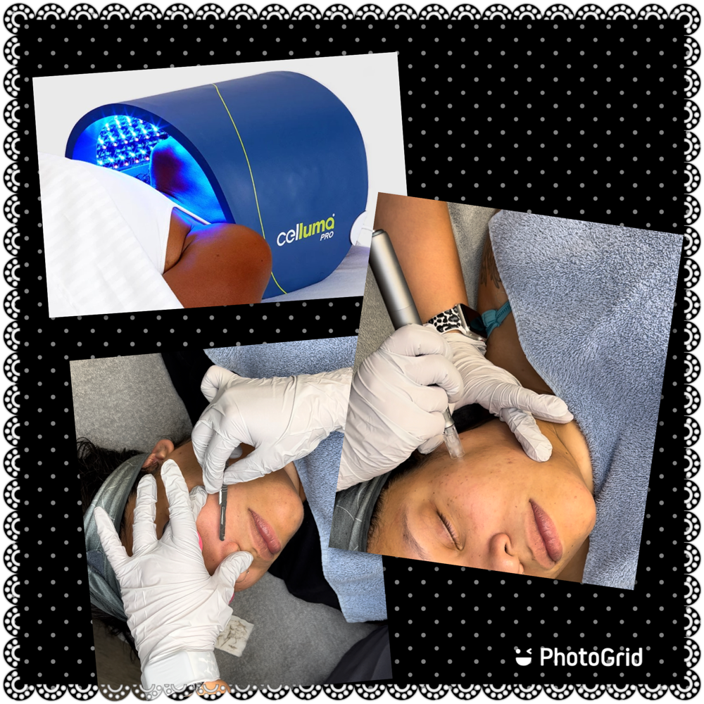 Dermaplane/NanoFusion/Light Therapy