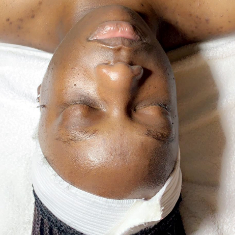 Deep Cleanse Facial at TheSkinOasis Beauty Bar in Conyers, GA