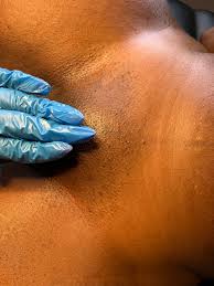 Brazilian Wax (V)