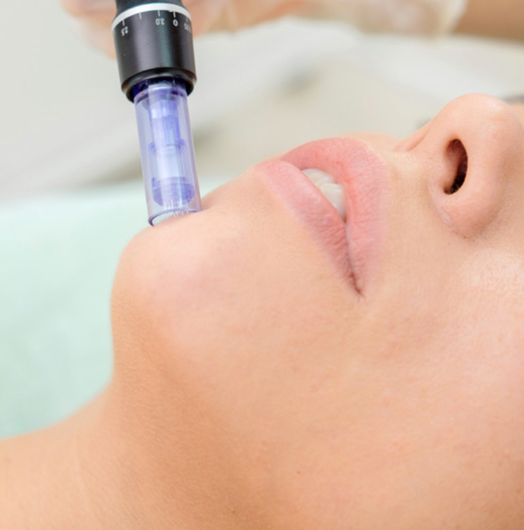 Vitamin C Infusion Facial