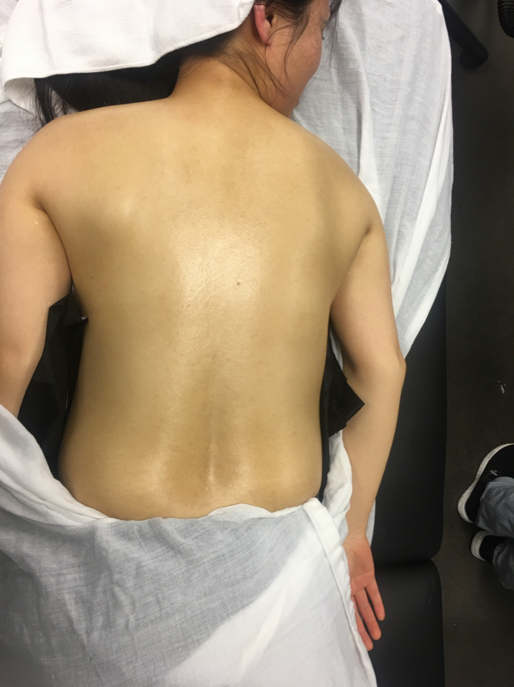 Back Facial at LushByLyse Beauty & Cosmetics in Del City Oklahoma, OK