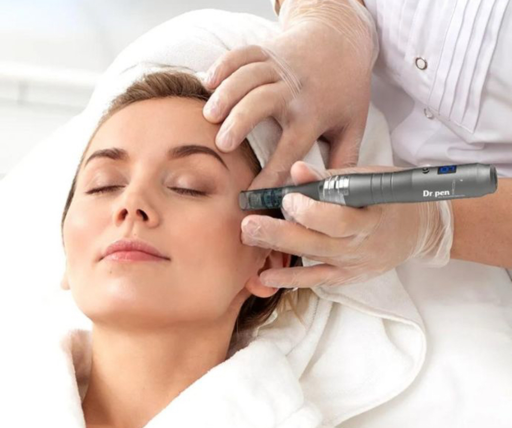 Microneedling Package (3)