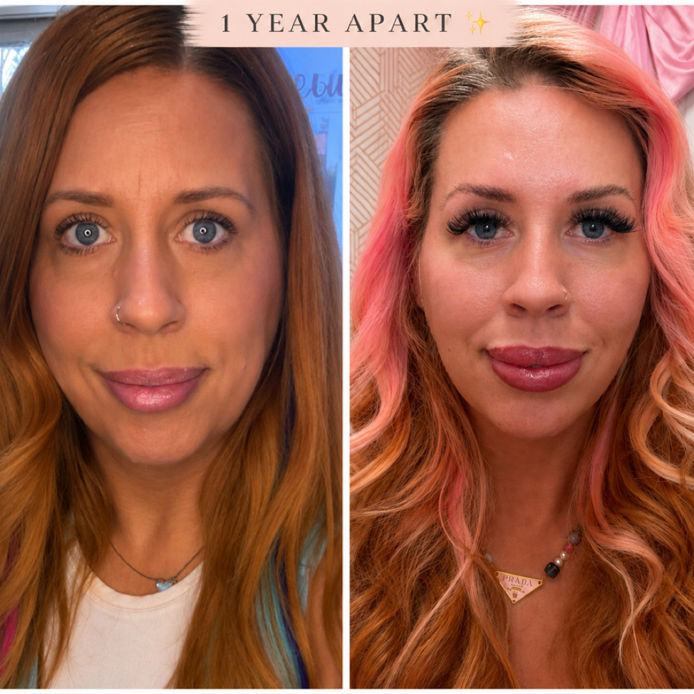 Facial Balancing at Alt Boutique & Aesthetics | Nurse Injector in Hereford, TX