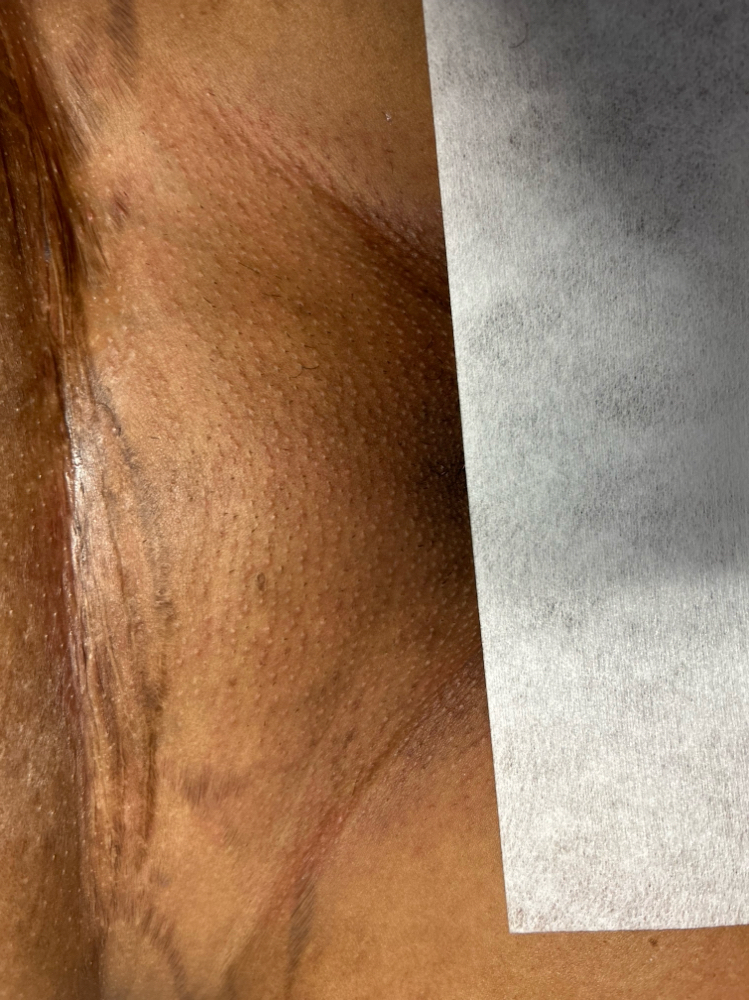 Brazilian Wax