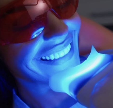 Teeth Whitening (60 Minutes)