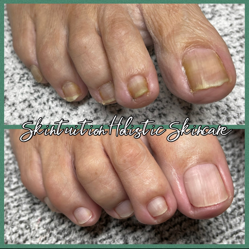 Tidy Toes EXPRESS PEDICURE | Maintenance