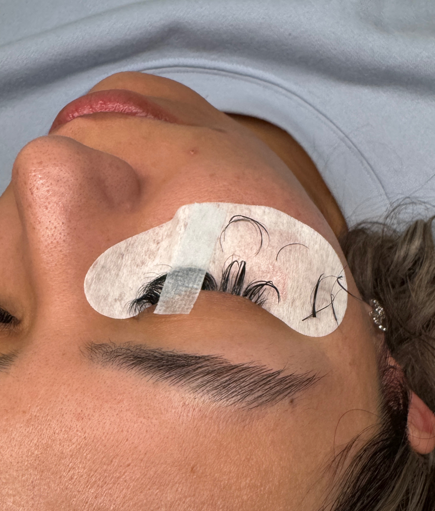Lash Removal