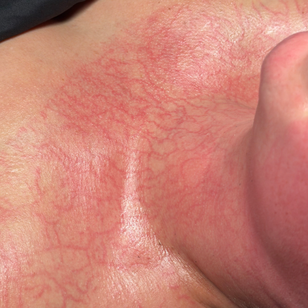 DMK Enzyme Therapy at Cass Corrective in Chesterfield, MI