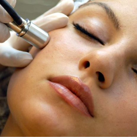 Micro/Hydro Dermabrasion - 60 Mins at Sheri  Day Spa by the Sea in Morehead City, NC