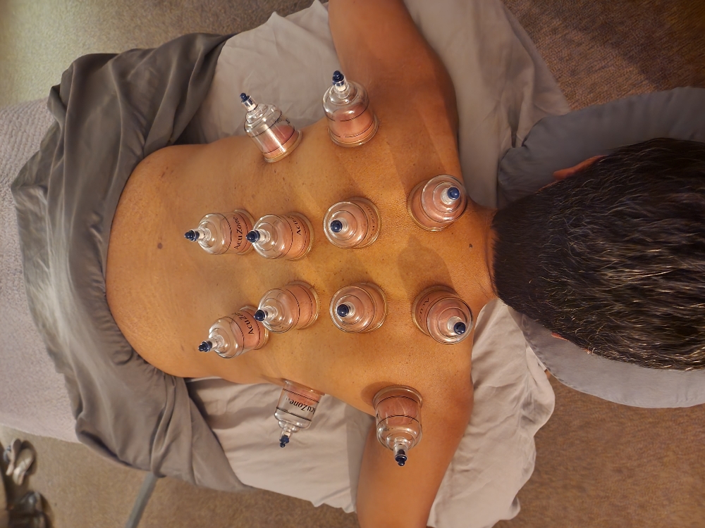 30 Minute Cupping + massage