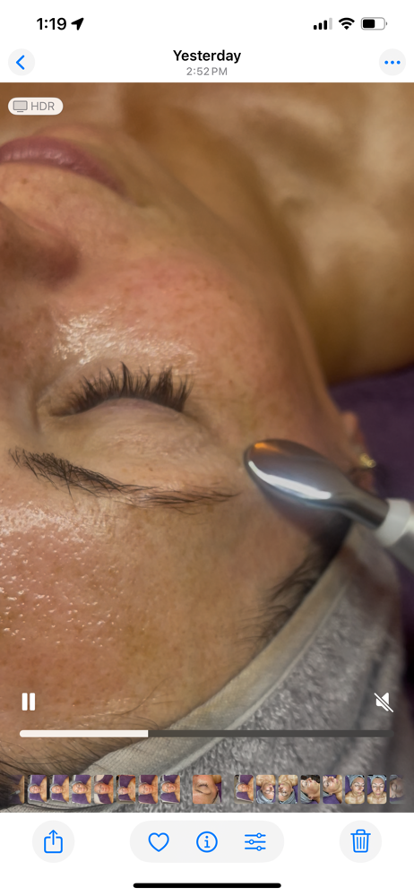 Add On Meso Eye Treatment