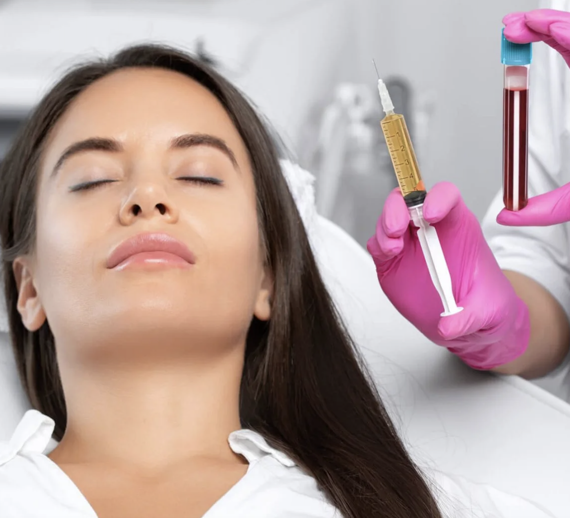 Microneedling w/PRP