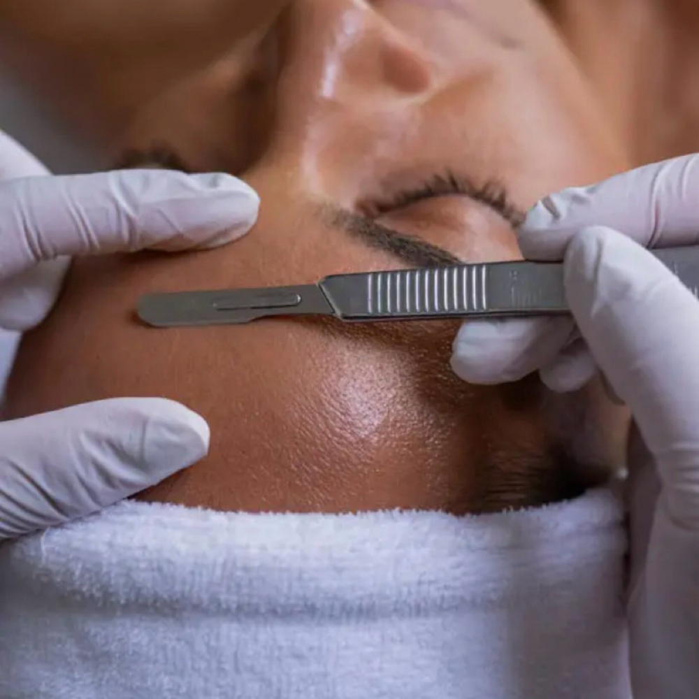 Dermaplane Facial at Vida Lux Salon And Suites in Weatherford, TX