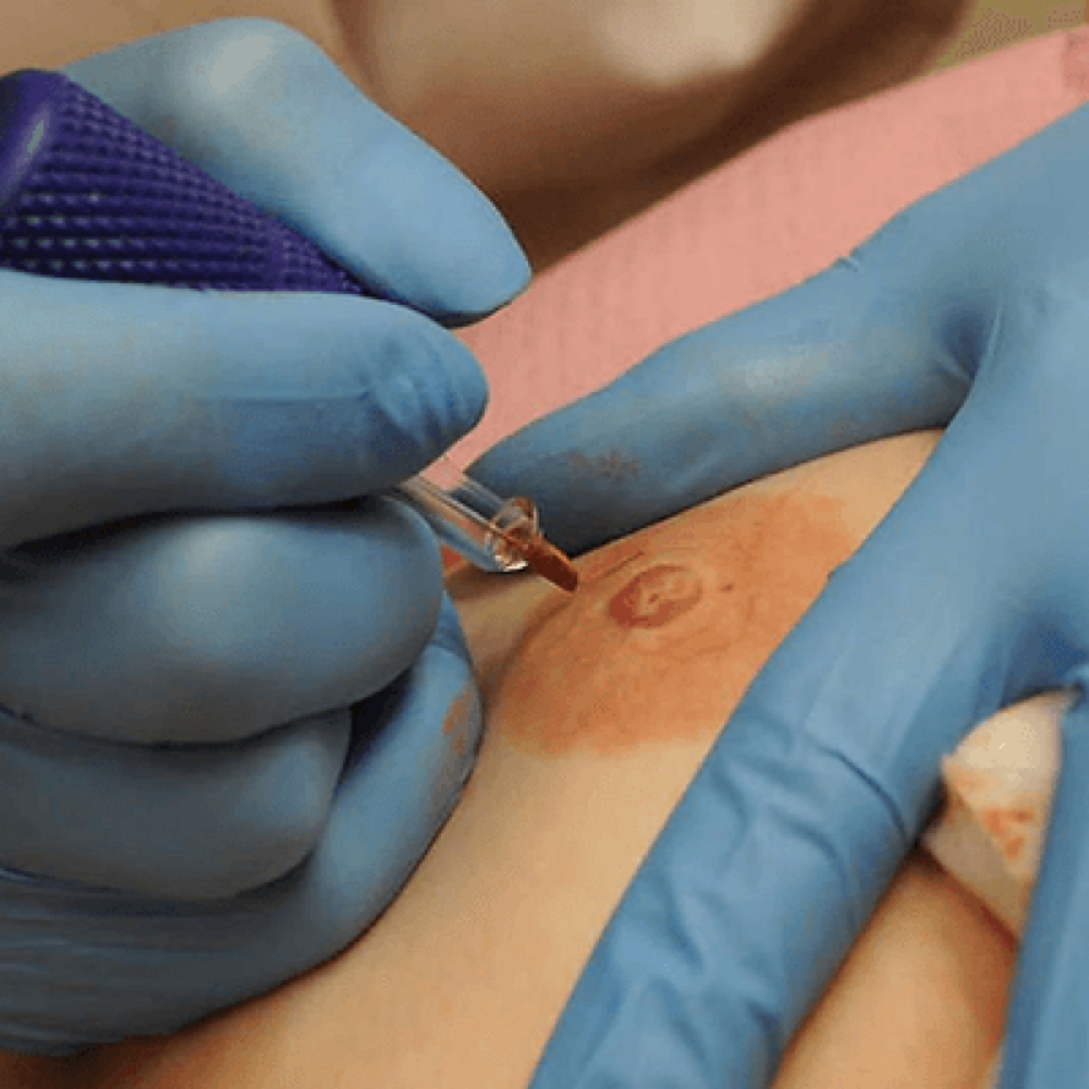 AREOLA 3D RESTORATION at BEAUTY LAB COLLECTIVE in Miami, FL