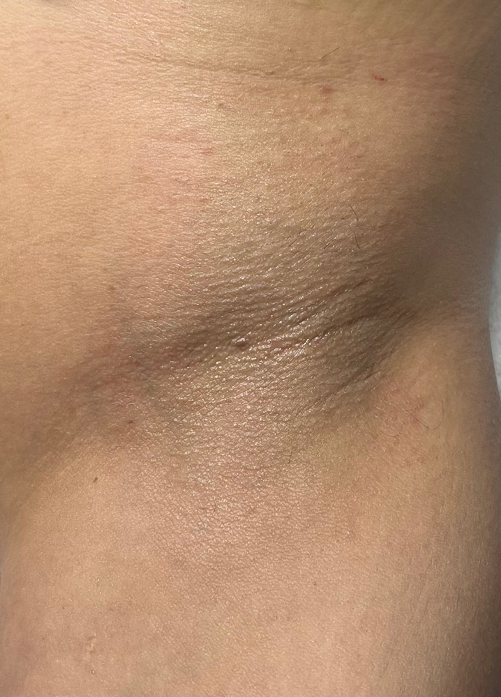 Under Arm Wax
