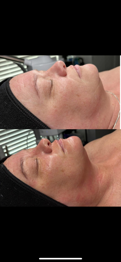 Firming Peptide Facial