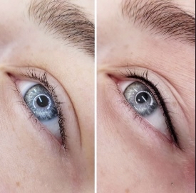 4-6 WK Lashline Retouch