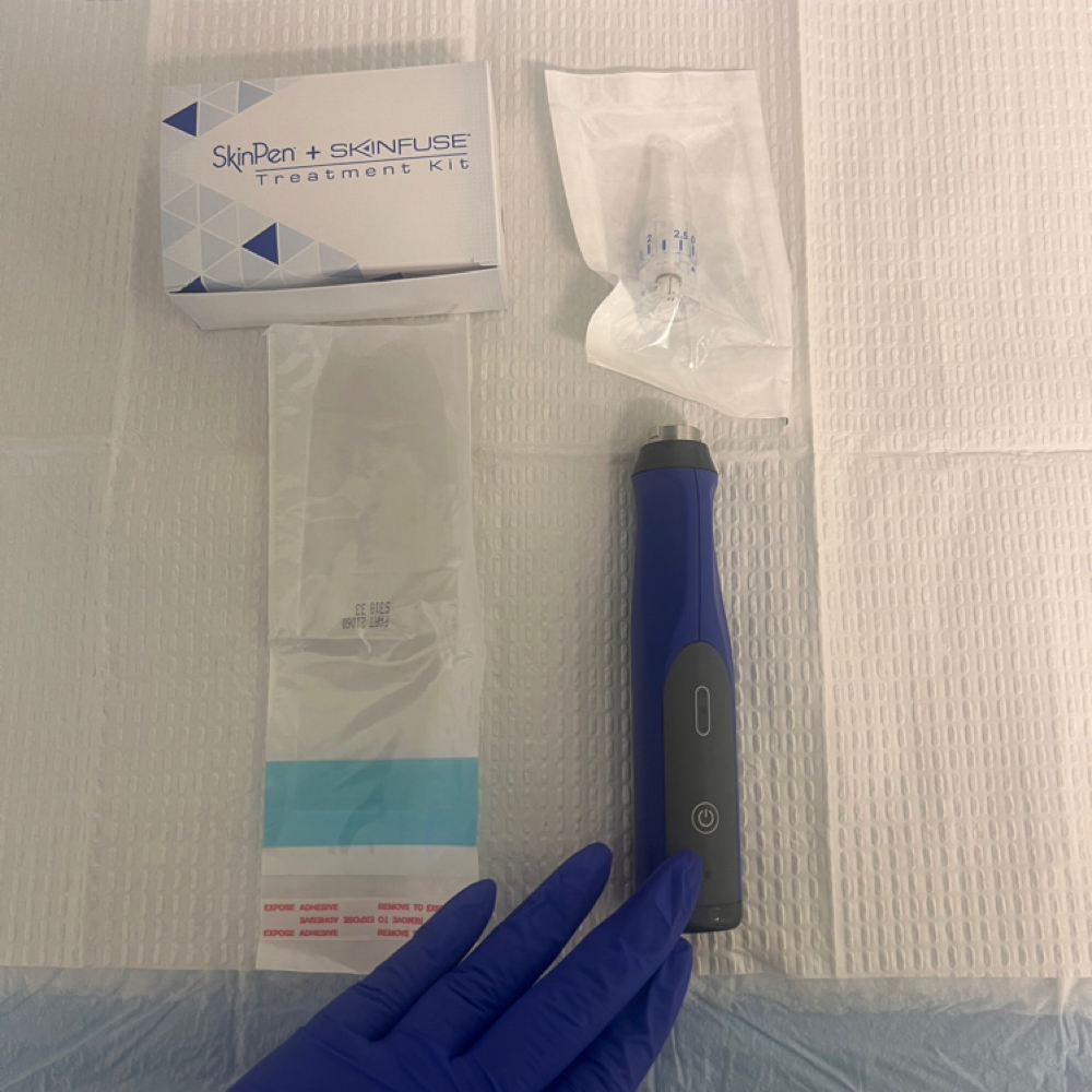 Microneedling Consultation at Glow Wellness Spa in Lafayette Hill, PA