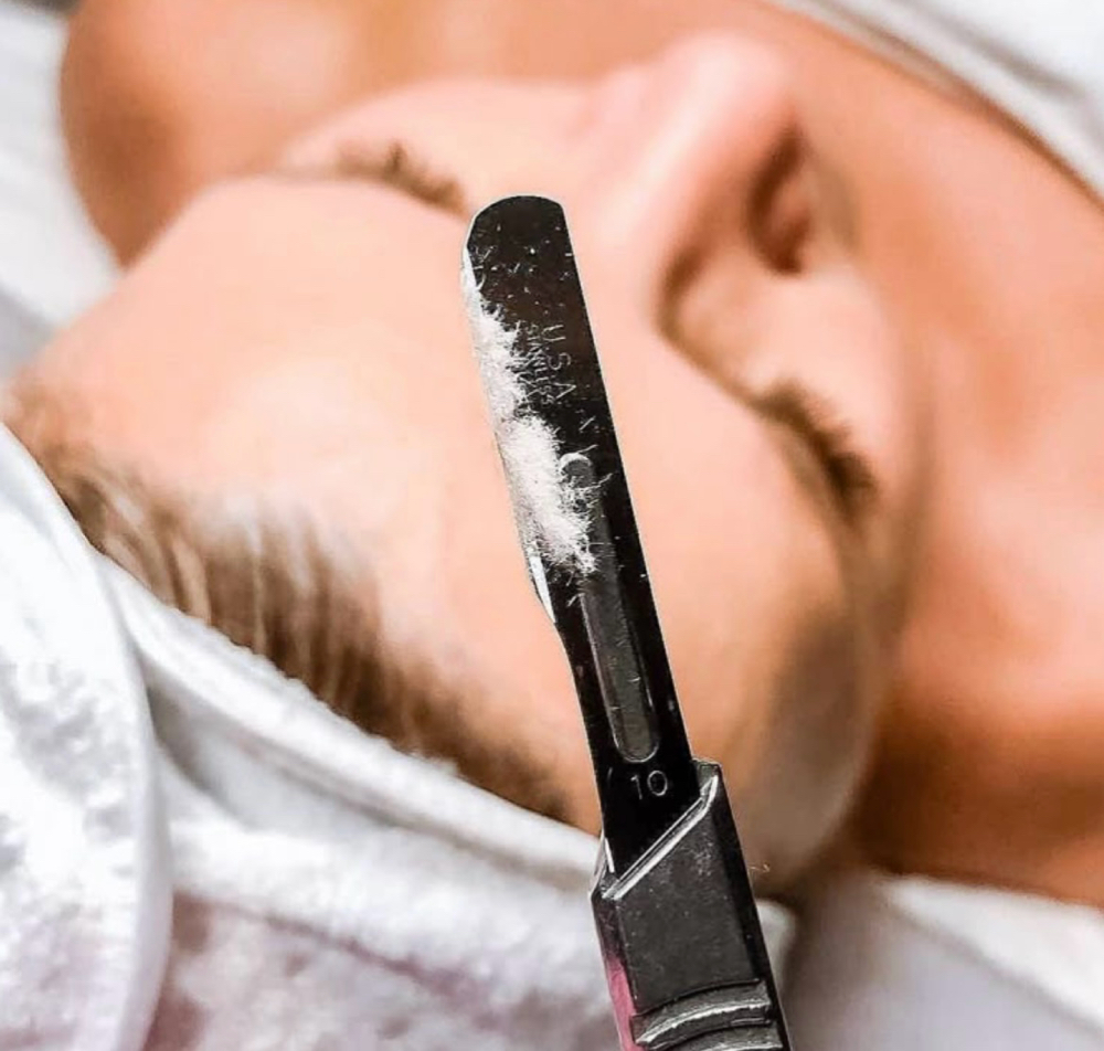 Dermaplane Facial at Skin By Ragan in Columbus, MS