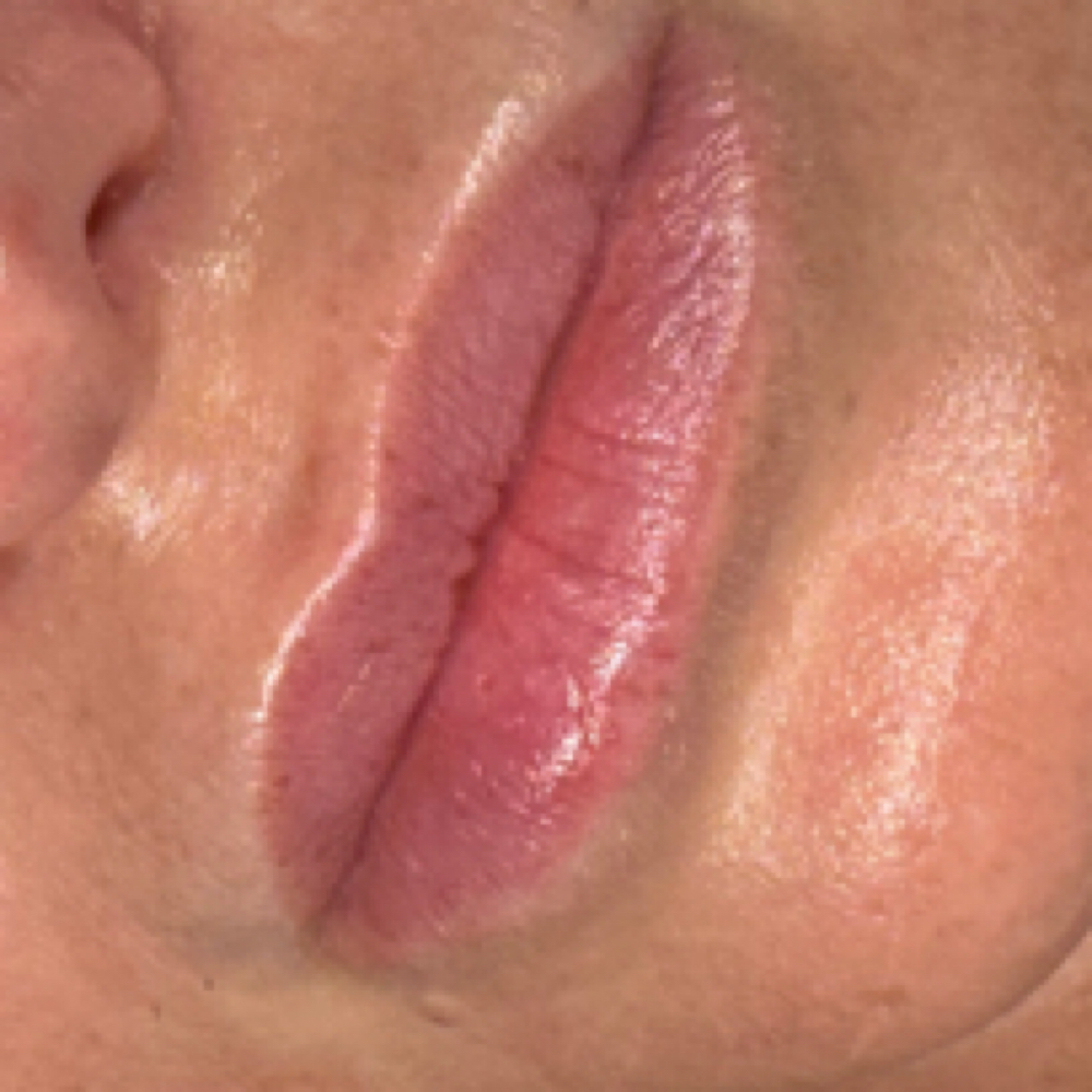 Hydrating Lip Treatment at Skin Babe Studio LLC in Fernandina Beach, FL