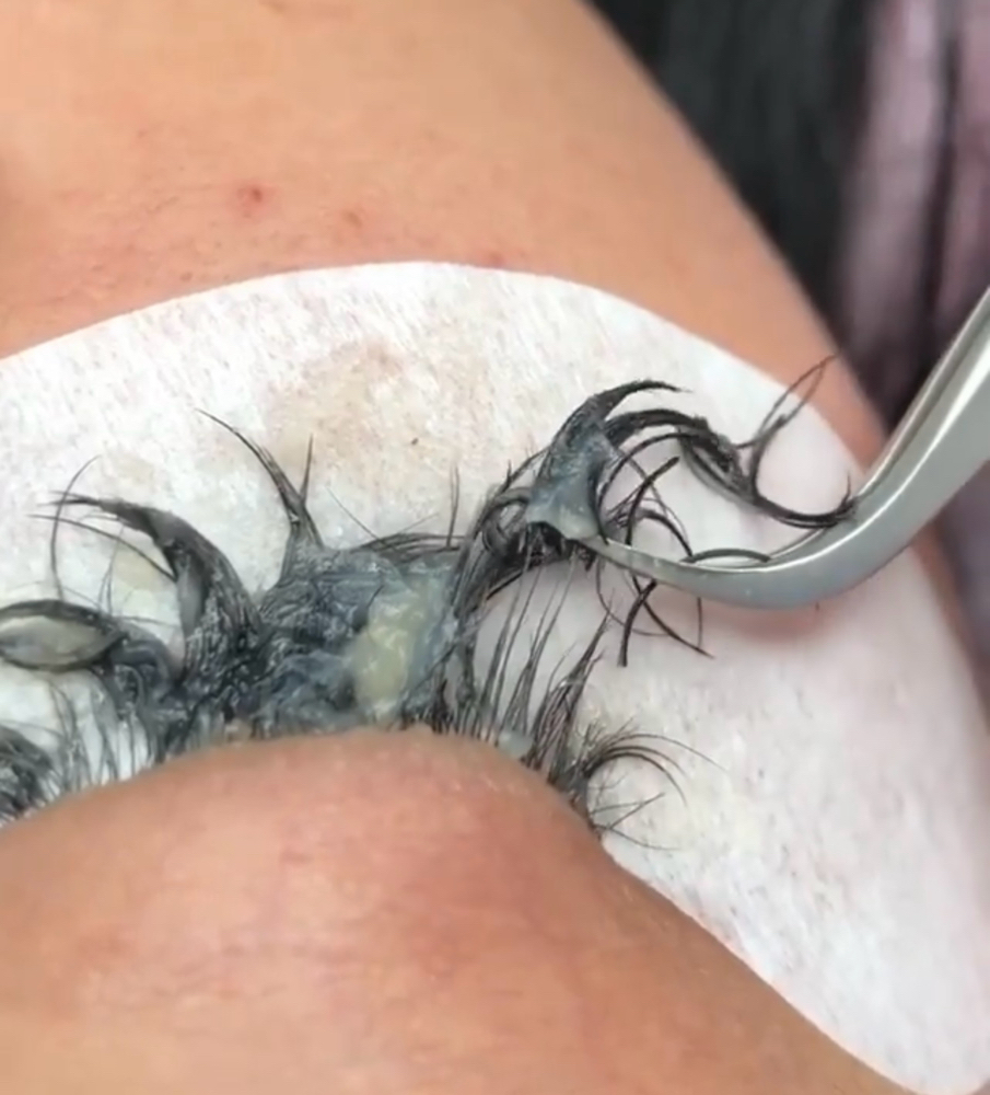 Eyelash Extension REMOVAL