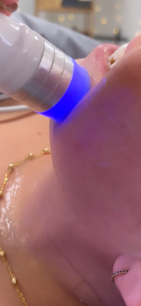 Non Invasive Facelift