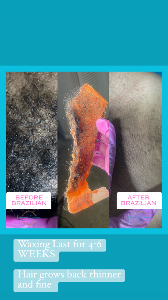 Brazilian Plus Underarm combo at Crowned Exclusive Esthetics in Kansas City, MO