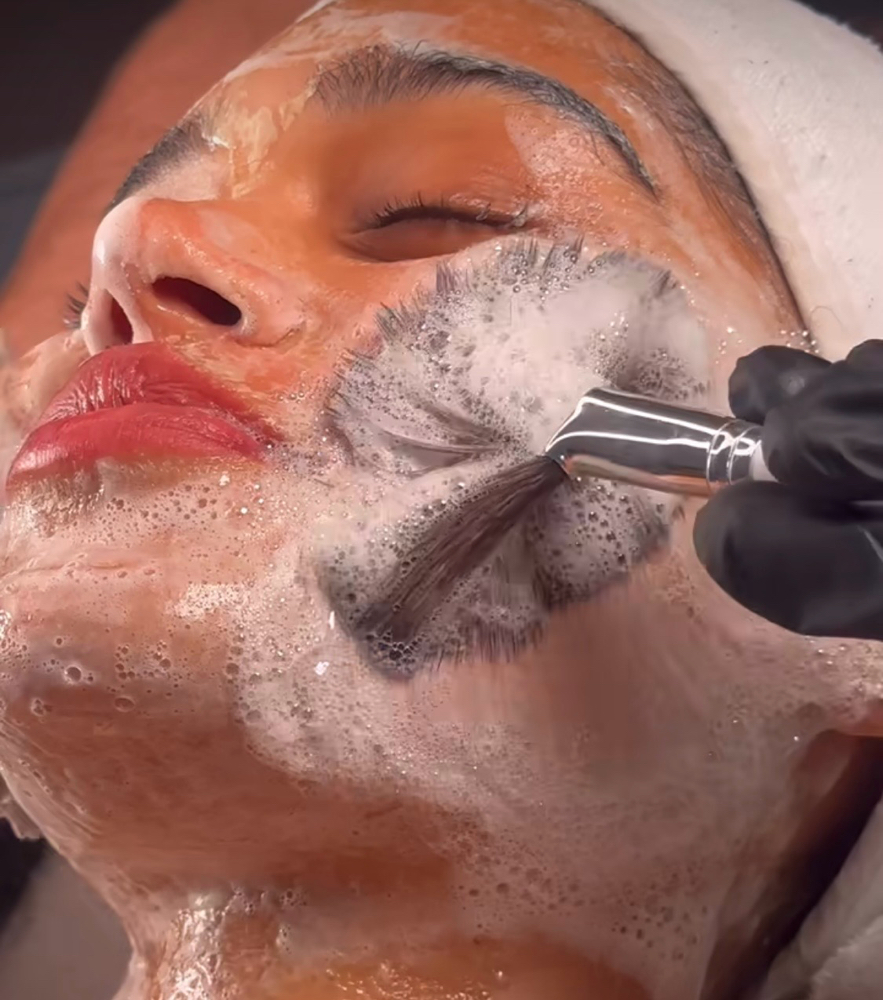 Deep Cleanse Facial & Extractions at ReNew in Fort Lauderdale, FL