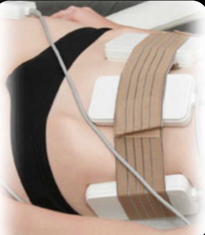 Laser Lipo 3 Treatments