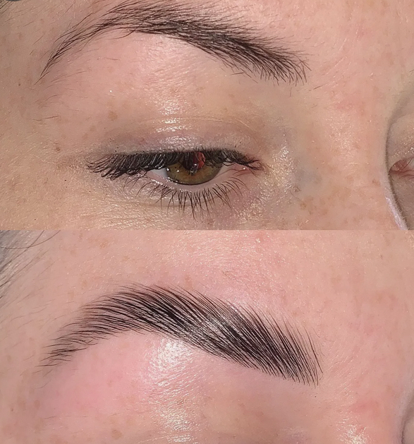 Brow Lamination