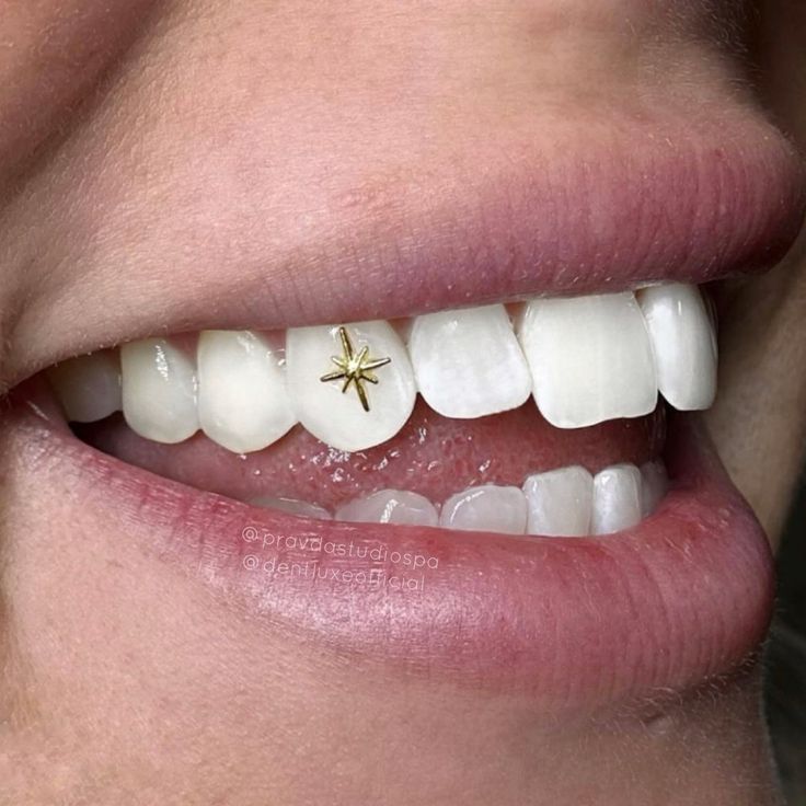 18K Gold Tooth Gem