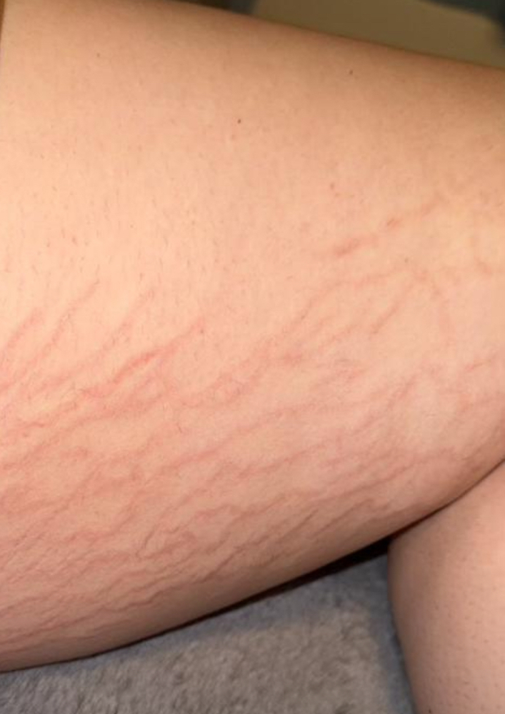 Inkless/Camo StretchM Inner Thighs