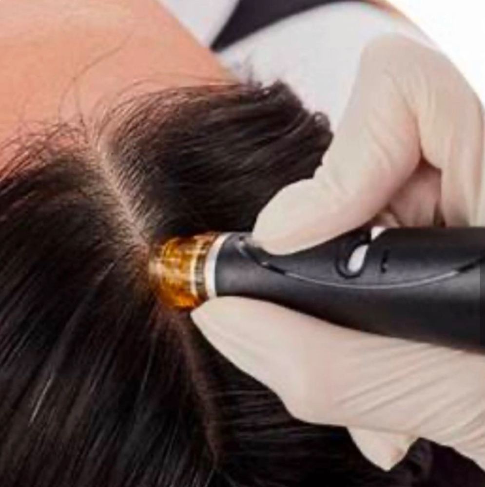 HF Keravive Scalp Treatment