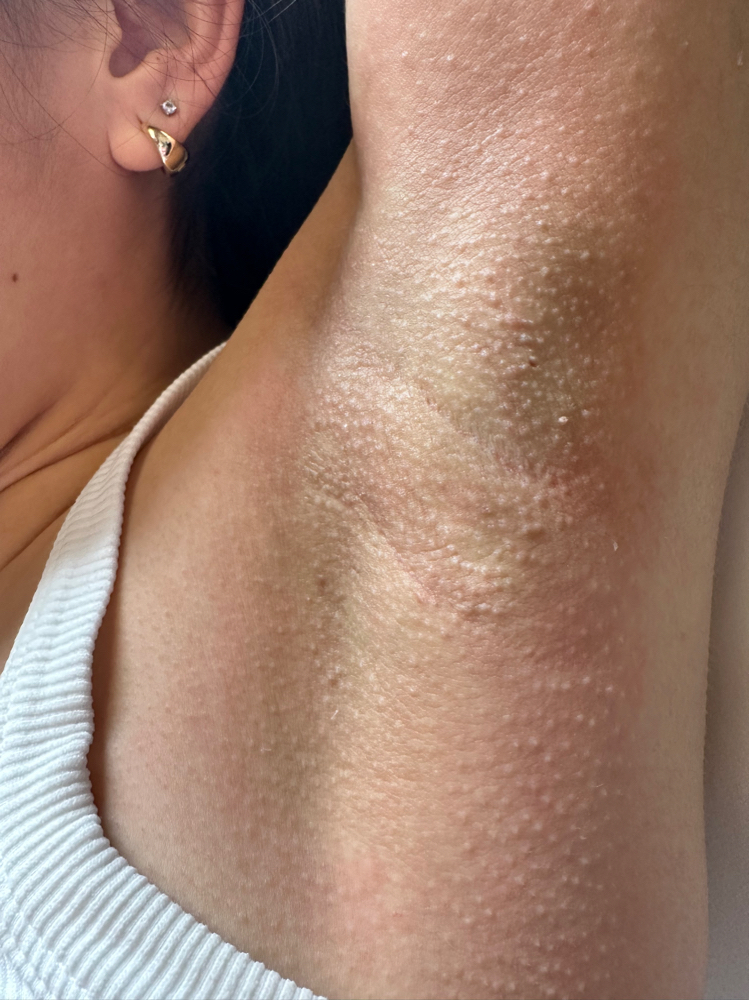 Under Arm Wax