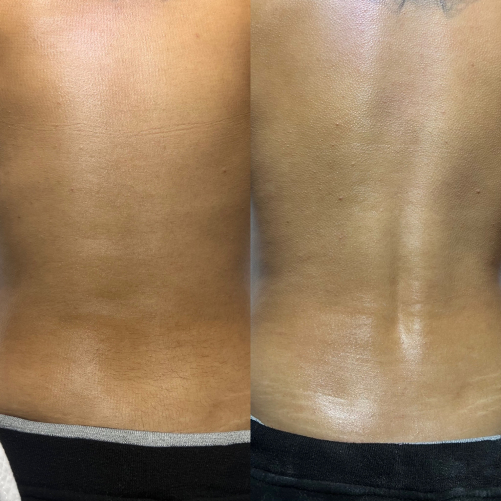Back Wax