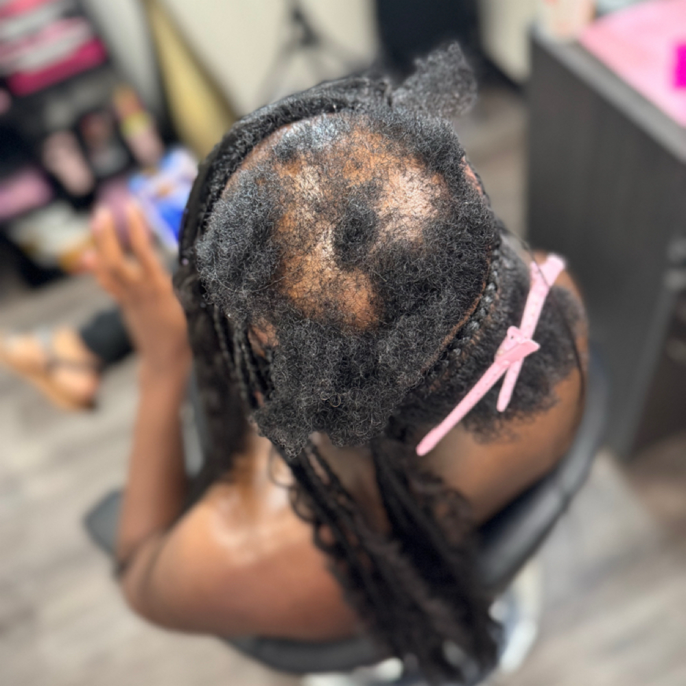 Alopecia Braiding at Mejko braid studio in Inglewood, CA
