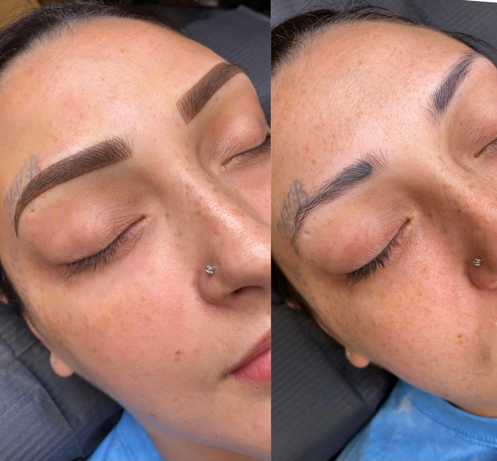 Brow Correction (Previous Work)