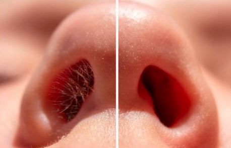 Nose Wax
