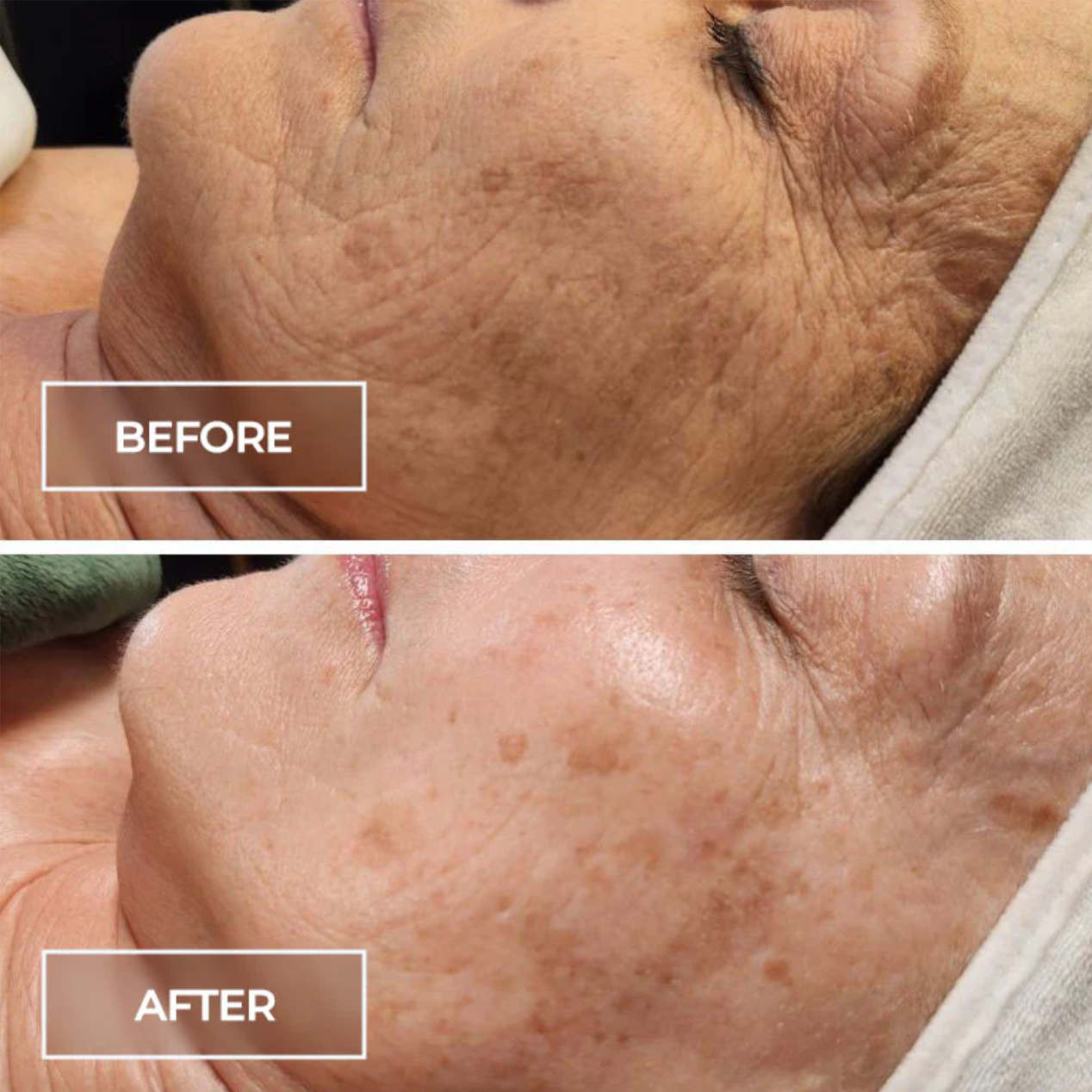Swich Custom Facial at Tasha Bruno Beauty & Esthetics in Windermere, FL