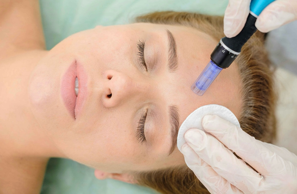 Botox Boost w/ Microneedling