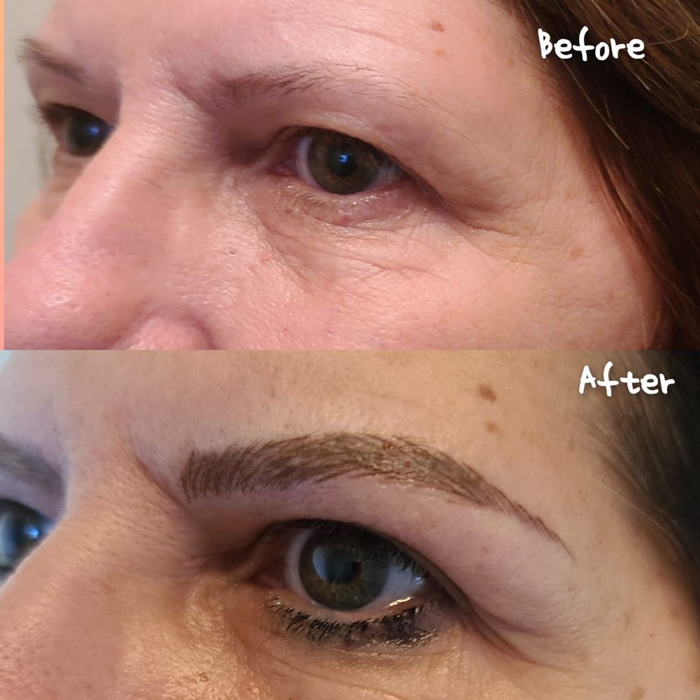 Brow Enhancement