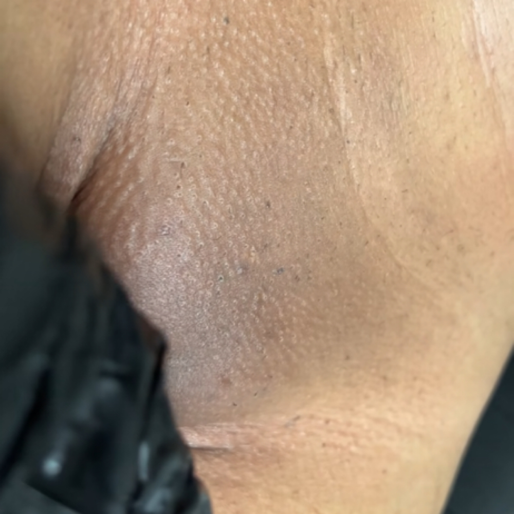 Content Model✨Brazilian at Sandy’s Aesthetics LLC in Lake Bluff, IL