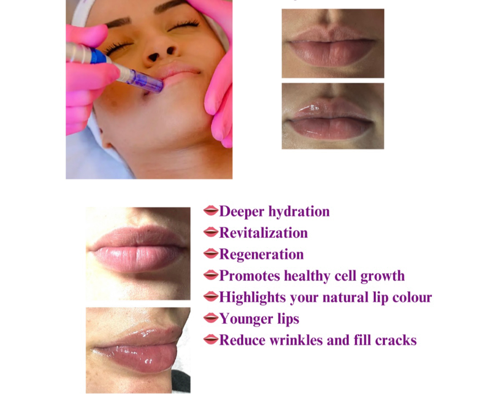 Hydralips