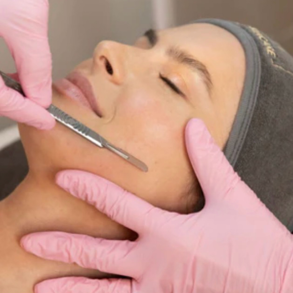Dermaplaning at Rise iV & Beauty Bar in New Braunfels, TX