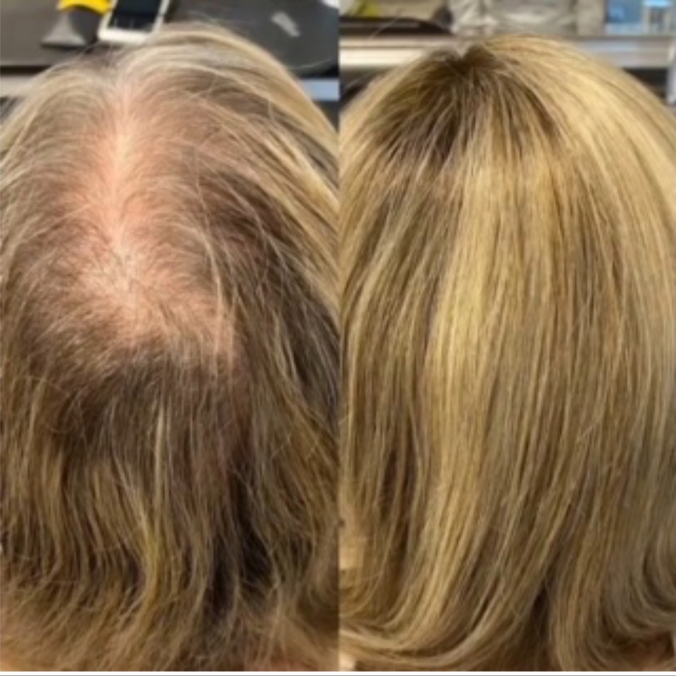 Partial Hair Integration Consult at NEDE Beauty Collective in Rockwall, TX